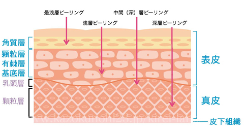 ケミカルピーリングの深さによる分類