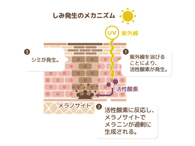 海外ブランドの化粧品開発は、シミのメカニズムをずーっと研究し続けてきた日本の技術には追いついていません。