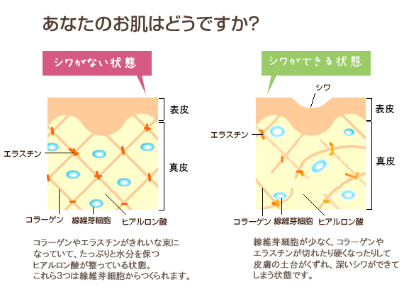 紫外線（UVA）でシワができるメカニズム