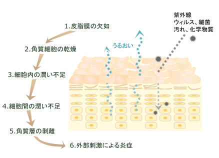 肌フローラが乱れると起こる肌トラブル