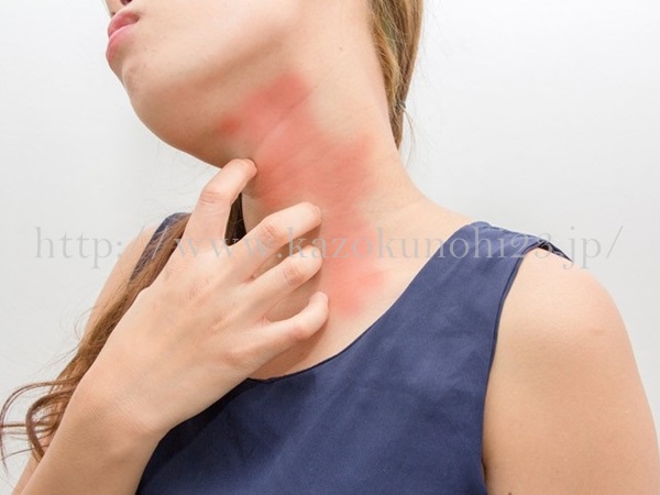 ただの肌荒れとアレルギーによる肌荒れの見分け方として、首元のかゆみがある場合はアレルギーなどが多いそうです。