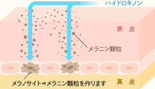 メラノサイトを減らす