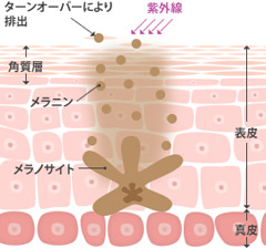 トレチノインの効果