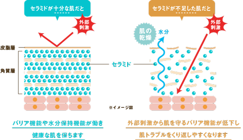 セラミド