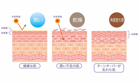 シミ・そばかすの原因や予防