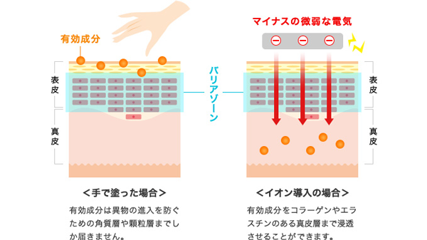 イオン導入にビタミンC誘導体化粧水を使うメリットは？