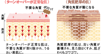 肌の乾燥