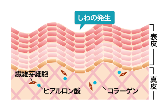 肌の乾燥や乾燥ジワ、たるみ