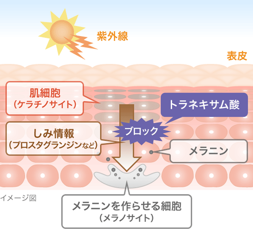 トラネキサム酸を改善する