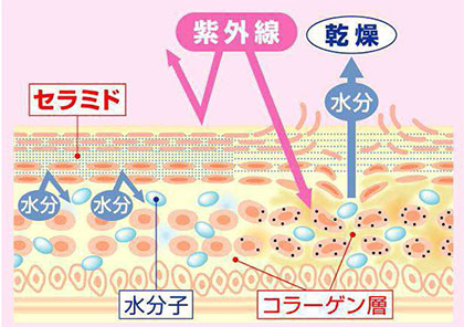 セラミド