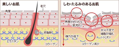 若々しいお肌と、しわ・たるみができたお肌の断面図を比較