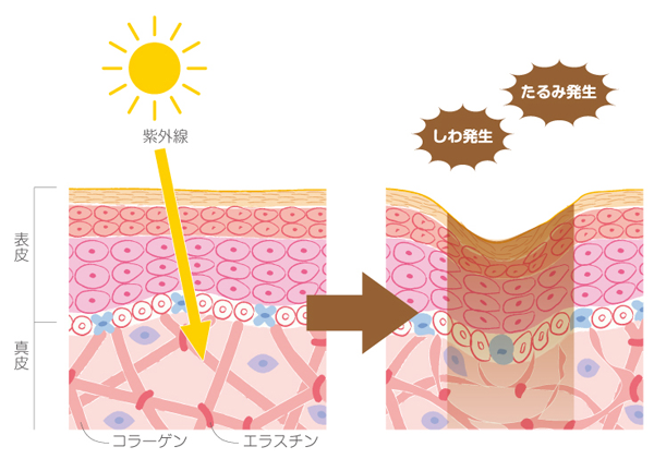 真皮層の老化