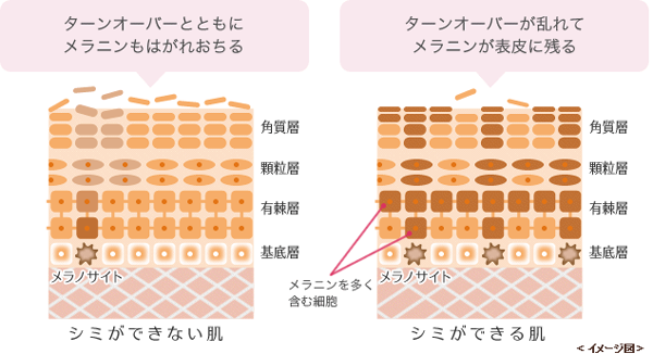 ーンオーバーが乱れた状態が長く続くと、メラニンを含んだ古い角質がいつまでも肌表面（表皮）に残り続け、真皮にも沈着してしまうのです。