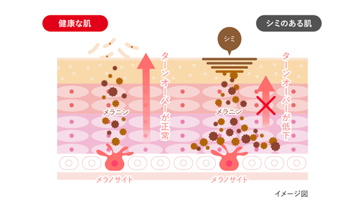 健康な肌とシミのある肌の違い