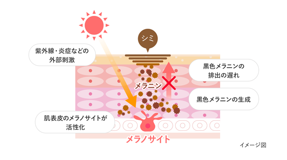 間違えたスキンケアでシミができるメカニズム