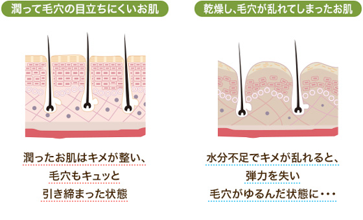 肌の乾燥によって毛穴が開く